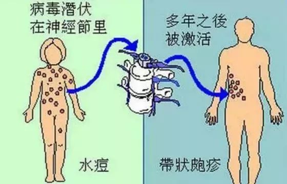 喷门迟缓症最新疗法研究与应用